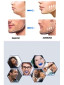 Çene Egzersiz Topu Çene Çizgisi Güçlendirici thumbnail 3