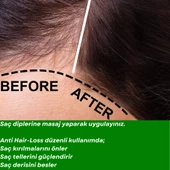 ANTI HAIR LOSS- 10 FORCES Saç Dökülmelerine Karşı 10 Aromatik Yağ Karışımı - 4