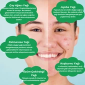 ANTI-ACNE SERUM Akne Karşıtı Yüz Serumu - 3