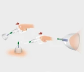 Vakumlu Göğüs Büyütücü - 2