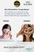 Soğuk Sıcak Uygulama Göz Terapi Rahatlatıcı Işık Göz Yorgunluğu Önleyici Jel Uyku Destekleyici Bandı thumbnail 4