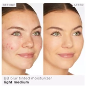 TARTE BB Blur Tinted Moisturizer Medium-tan - Renkli Nemlendirici Krem 30 ml - 3