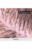 L'OREAL PROFESSİONNEL Serie Expert Scalp Advanced Yağlanma Karşıtı Profesyonel Şampuan 500ml - 8