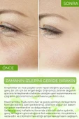 Siyah Nokta Akne Giderici Gözenek Sıkılaştırıcı Vivo Series A210 - 5