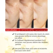 Sérum Premium Au Rétinol, Anti-Rides & Anti-Âge, Illuminateur – Xella Series A220 thumbnail 2