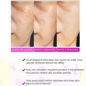 Sérum Anti-Acné, Anti-Points Noirs, Purifiant – Elixir Series A260 thumbnail 4