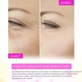 Sérum Anti-Acné, Anti-Points Noirs, Purifiant – Elixir Series A260 thumbnail 5