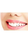 MY ASORTİK BİJUTERİ HEDİYELİK Kristal Diş Taşı Diş Pırlantası Diş Diştaşı - 3