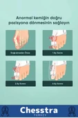 Yumuşak Yıkanabilir Bedensiz Koruma Aparat Sağ Sol Ayak Uyumlu Baş Parmak Kemik Düzeltici 4 Adet - 2
