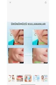 Melistansu Yüz ve Boyun Güzellik Cihazı Gıdı Sarkma Kırışıklık thumbnail 4