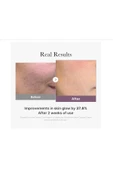 AGE-R GLUTATHIONE GLOW CAPSULE CREAM 50ml Yüz Kremi - 4