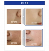 Desembre 3in1 Peeling Cream ( 3'ü 1 arada Peeling Krem) - 3