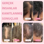 Boldify Saç Dolgunlaştırıcı Fiber Topik Tozu Açık Kahve 28gr - 3