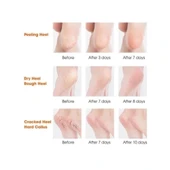 Silikon Topuk Nemlendirici Çorap - 4