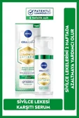 Nivea Luminous630 Sivilce Lekesi Karşıtı Serum 30 Ml, Karma Yağlı Ciltler,salisilik Ve Hyaluronik Asit - 8
