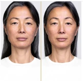 Shiseido  Vital Perfection Night Concentrate - Gece Serumu 40 ml thumbnail 2