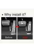 YıldızTuning Mercedes E W211 2002-2009 Otomatik Metal Pedal Seti - 5