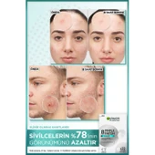 Pimple Patch 22'li Sivilce Bandı / Hidrokolloid Bant - 5