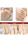 MJCARE Miracle Foot Peeling Pack - Mjcare Çorap Tipi Ayak Peeling Maskesi - 3