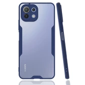 Xiaomi Mi 11 Lite Kılıf Platin Matte Silikon Arka Kapak - 5