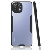 Xiaomi Mi 11 Lite Kılıf Platin Matte Silikon Arka Kapak - 3