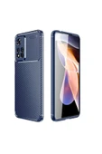 Xiaomi Redmi Note 11 Pro Plus 5g Kılıf Kamera Çıkıntılı Karbon Fiber Dokulu Renk Atmaz Kapak (negro) - 1