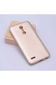 Lg K11 Kılıf Yumuşak Dokulu Soft Esnek Ince Mat Renkli Silikon Kapak (premier) thumbnail 1
