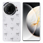 Tecno Camon 30 Pro 5G Kılıf Airbag Tasarımlı Simli Şeffaf Zore Kutup Kapak - 2