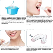 Dental Guards Gece Ağız Koruyucu, diş Gıcırdatma,çene Sıkma,bpa Içermez,rahat Uyku Için Özel Tasarım - 2