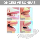 Moldable Vivostar Takma Diş, Protez Diş, Diş Dolgusu, Geçici Diş, Diş Onarımı - 2