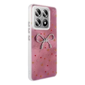 Xiaomi 14T Pro Kılıf Figürlü Kamera Korumalı Silikon Zr-Ponti thumbnail 3