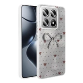 Xiaomi 14T Pro Kılıf Kamera Korumalı Figürlü Zore Ponti Silikon Kapak - 5