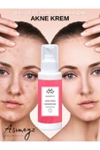 ASİMEYZ Sivilce Önleyici Ve Sivilce Karşıtı Akne Siyah Nokta Giderici Nemlendirici Krem Anti-Acne 150 ml - 3