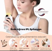IPL Epilasyon Cihazı - 5