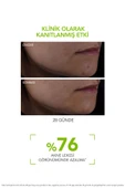 BİODERMA Sebium Serum - 2