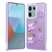 Xiaomi Redmi Note 13 Pro 5G Kılıf Parlayan Simli Kabartma Figürlü Zore Cevze Kapak - 1