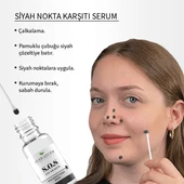 Siyah Nokta Karşıtı Serum 20ml - 5