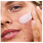 First Aid Beauty Ultra Repair Rescue Balm - Dimetikonlu Ultra Onarıcı Rahatlatıcı Balsam 64 gr - 4