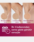 Philips Lumea BRI950/00 Lumea Lazer Epilasyon IPL Tüy Alma Cihazı Yüz+Vücut+Hassas bölge Kullanımı.Kablolu Kablosuz Kullanım - 2