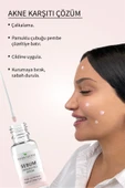 Herbaderm Sebum Dengeleyici, Sivilce Karşıtı Serum thumbnail 3