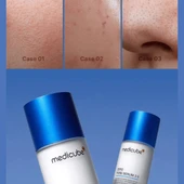 medicube - Zero Pore Serum (Gözenek Karşıtı Serum)(GLOBALCARE) - 3