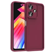 İnfinix Hot 30 Kılıf Kamera Korumalı Ananas Kapak thumbnail 11