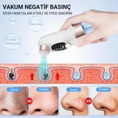 Coofbe Profesyonel Kirli-Temiz Sıvısı Hazneli 6 Başlıklı Şarjlı Vakumlu Siyah Nokta Akne Temizleyici Tüm Ciltler İçin thumbnail 6