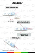 CSled  1.5W Sarı Modül Led 2835 SMD Mercekli  Yüksek Performans Düşük Enerji Tüketimi IP65 Suya Dayanıklı - 3