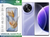 Tecno Camon 30S ile Uyumlu Hidrojel Ekran Koruyucu Film HD-ŞEFFAF(Tempered Cam Değildir!) - 1