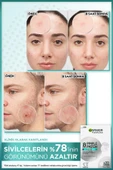 Garnier Pureactive Cilt Kusurlarına Karşı Band 22 Adet - 3