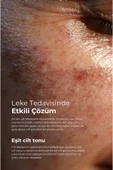CLİNİC LEKE KREMİ 75 ML - 4