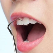 7 Parça Paslanmaz Çelik Ağız Diş Tartar Sökücü Temizlik Bakım Seti - 5