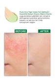 SİNOZ Pure Cica Tiger Grass Ton Eşitleyici Yoğun Onarıcı Yatıştırıcı Kızarıklık Karşıtı Yüz Kremi 15 ml - 5