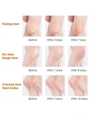 Silikon Topuk Nemlendirici Çorap - 2